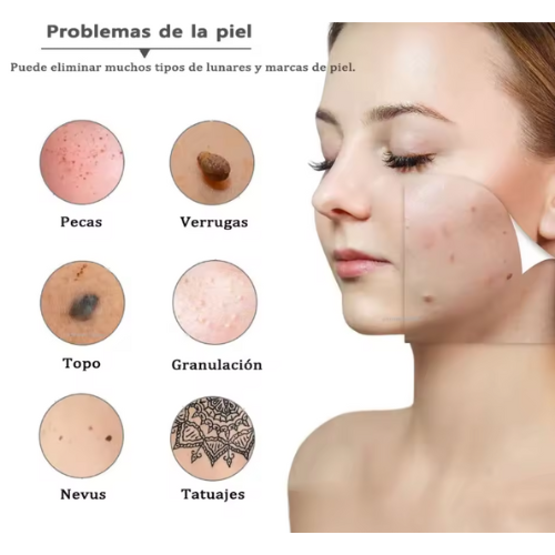 Eliminador de marcas en la piel