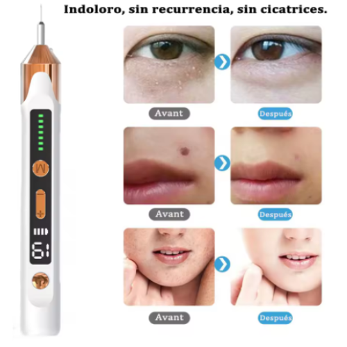 Eliminador de marcas en la piel